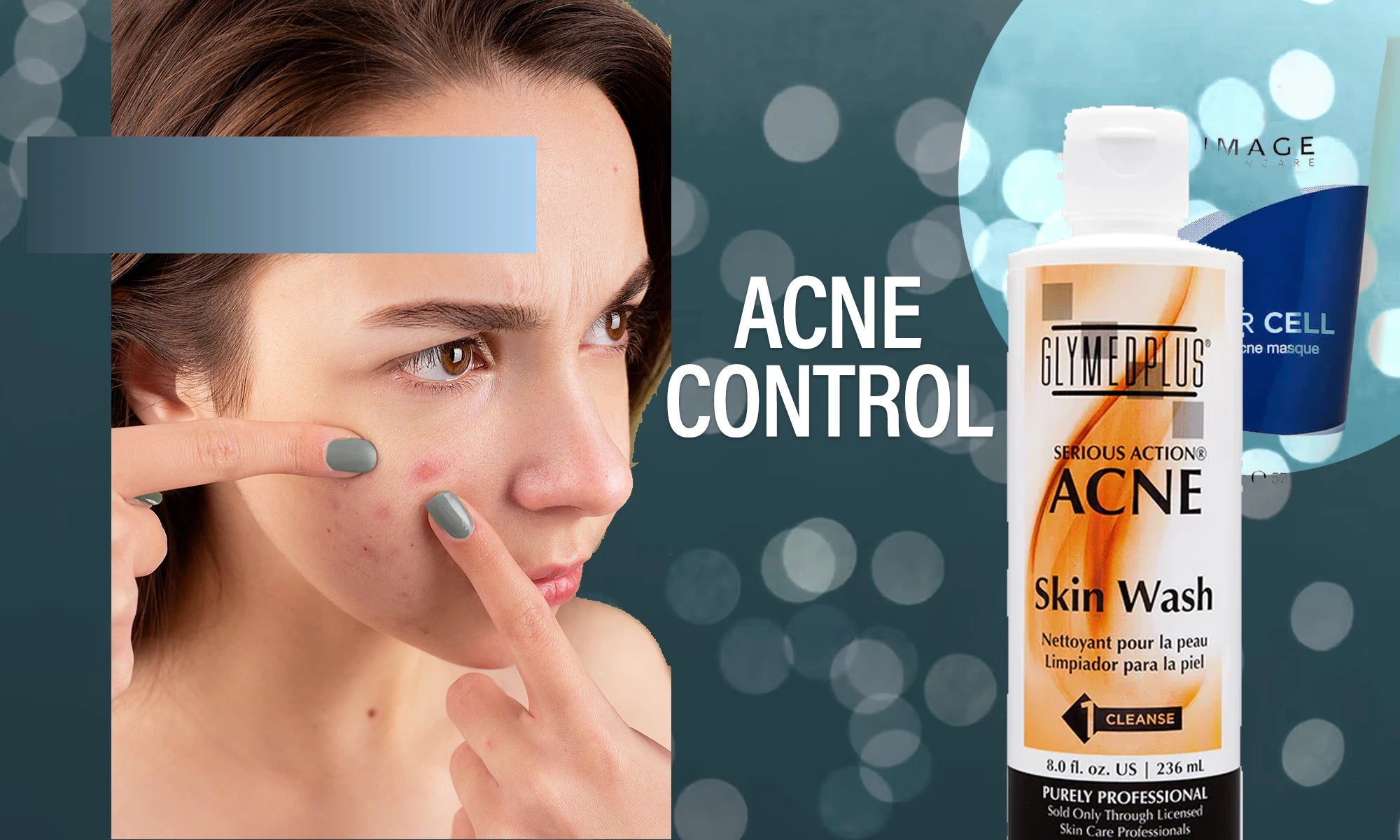 Acne Control banner image